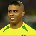 Ronaldo botakkk